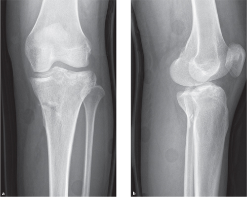 Orthopedic diagnosis and treatment at Sri Sai Krupa Hospital